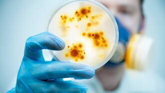 Καμπανάκι κινδύνου για τις λοιμώξεις και τα «πανανθεκτικά» μικρόβια χτυπούν οι λοιμωξιολόγοι
