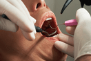 Ηλιούπολη: Εισαγγελική έρευνα για τον οδοντίατρο που είχε ιατρείο χωρίς πτυχίο