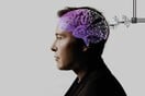 Ίλον Μασκ: Η Neuralink έκανε την πρώτη εμφύτευση μικροτσίπ σε ανθρώπινο εγκέφαλο