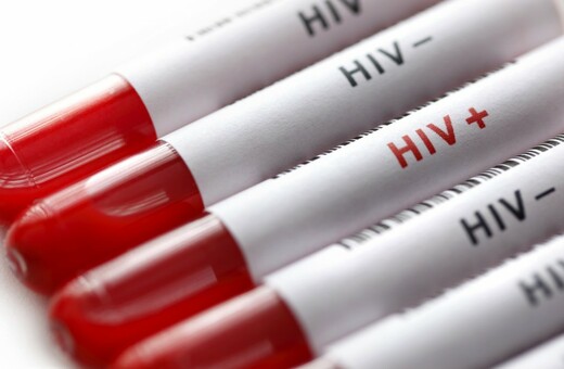 AIDS: Ασθενής με HIV έγινε ο πρώτος στον κόσμο που «πιθανώς θεραπεύτηκε» μόνο με αντι-ιικά φάρμακα
