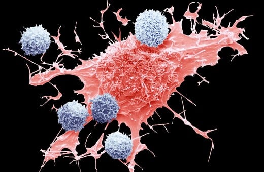Νέες εξετάσεις αίματος θα εντοπίζουν πρόωρα τον καρκίνο