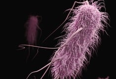 Η μικροβιακή αντοχή μπορεί να κάνει την επιδημία του κορωνοϊού να «μοιάζει με παιχνίδι»