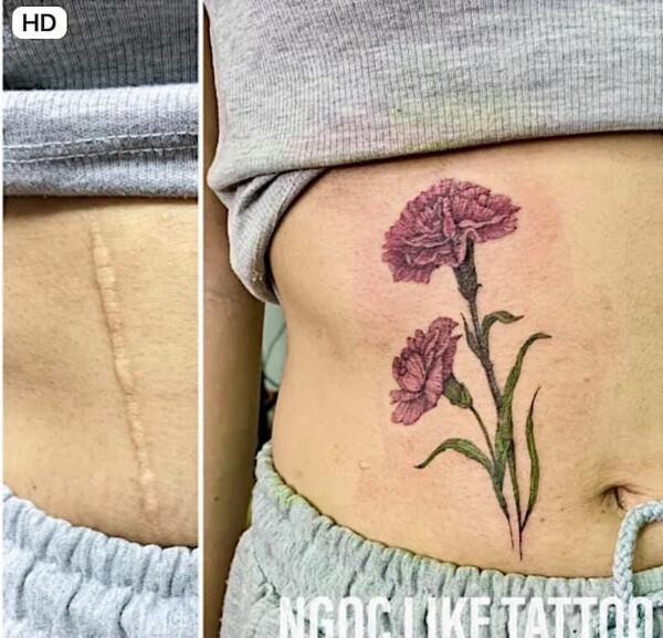 Καλλιτέχνιδα των τατουάζ στολίζει παλιές πληγές με λουλούδια και πορτρέτα ζώων