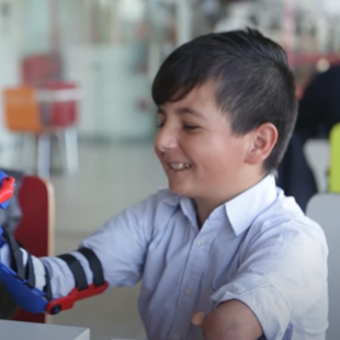 Ίδρυμα εκτυπώνει 3D προσθετικά μέλη και τα δωρίζει σε παιδιά στην Ουρουγουάη