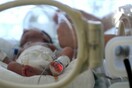 Γυναίκα εγκεφαλικά νεκρή για 3 μήνες γέννησε το μωρό της