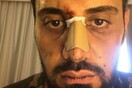 Τουρίστας καταγγέλλει ρατσιστική επίθεση εναντίον του στο Γκάζι - Διαμαρτύρεται για διακρίσεις από τις αρχές