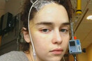 Η Εμίλια Κλαρκ εξομολογείται: «Λείπουν» μέρη του εγκεφάλου μου εξαιτίας ανευρυσμάτων