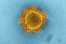 Khosta-2: Εντοπίστηκε νέος ιός που μολύνει τον άνθρωπο και διαφεύγει των εμβολίων του κορωνοϊού