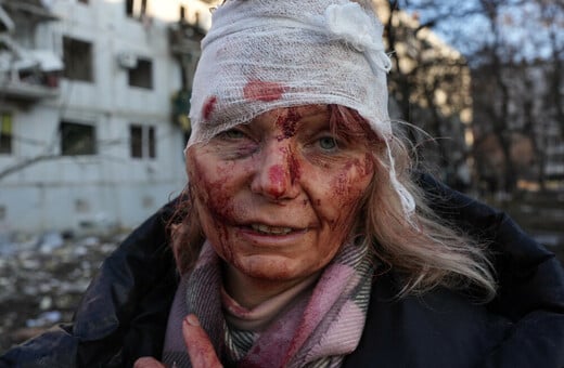 Ukrainian Teacher Speaks Out After Photos of Her Injuries Became a Haunting Symbol of the War