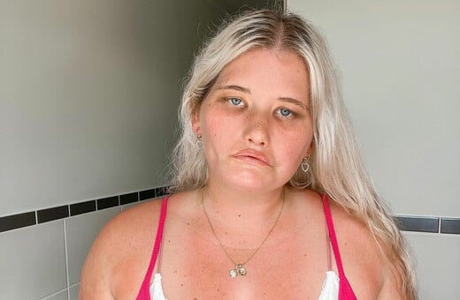 Woman who can’t smile due to rare condition signs with modeling agency