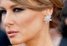 Αιδοιοπλαστική και «The Melania»: Οι νέες μεγάλες τάσεις στις πλαστικές επεμβάσεις που προκαλούν ανησυχία