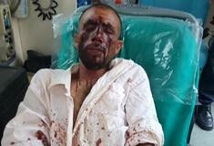 Σοβαρή καταγγελία για δολοφονική επίθεση κατά μεταναστών εργατών από φασίστες στον Ασπρόπυργο