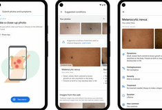 Google: Εργαλείο με τη χρήση τεχνητής νοημοσύνης μπορεί να βοηθήσει ασθενείς να αναγνωρίσουν δερματικές παθήσεις