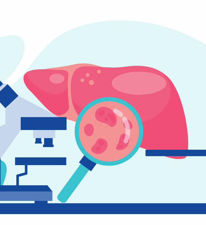 Οι χρόνιες ηπατίτιδες Β και D αποτελούν σοβαρά προβήματα δημόσιας υγείας, που μπορούν να αντιμετωπιστούν