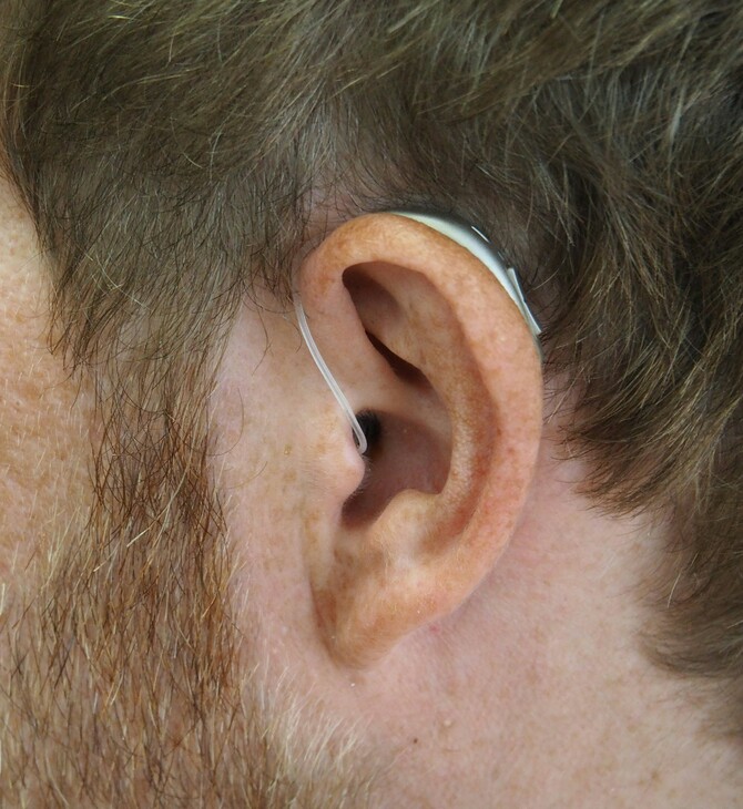 Νέα μελέτη δείχνει πως η χημειοθεραπεία μειώνει την ακοή των επιζώντων καρκίνου