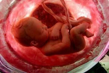 Έγινε επέμβαση σε έμβρυο κατά την διάρκεια της κύησης