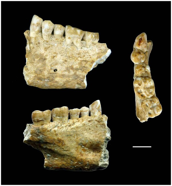 Οι προϊστορικοί άνθρωποι πήγαιναν στον οδοντίατρο