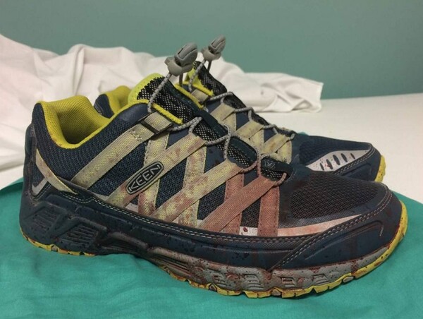 Γιατρός του νοσοκομείου στο Ορλάντο ανεβάζει στο Facebook συνταρακτική φωτογραφία των ματωμένων του παπουτσιών