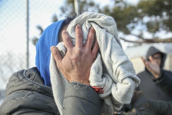 Επεισόδια και τραυματισμοί σε διαμαρτυρία προσφύγων στα Διαβατά