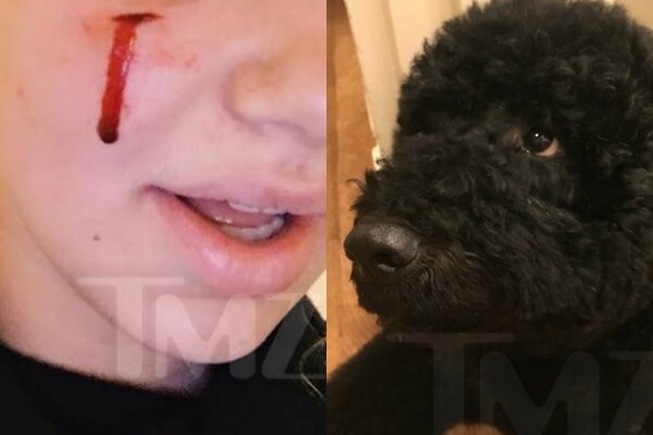 Η Sunny, ένας από τους σκύλους του ζεύγους Ομπάμα, δάγκωσε μια κοπέλα που θέλησε να την χαϊδέψει