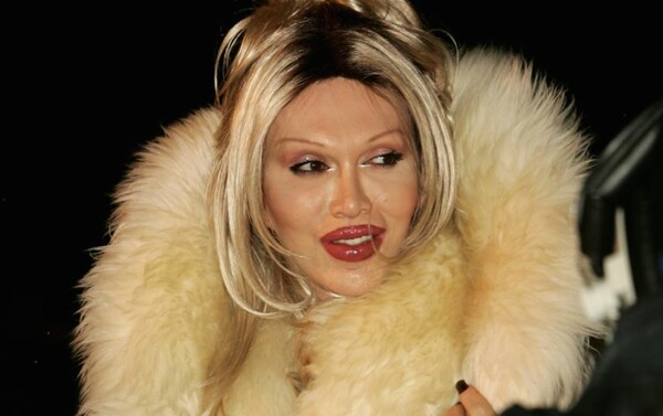 Πέθανε ο Pete Burns, τραγουδιστής και σταρ του Celebrity Big Brother