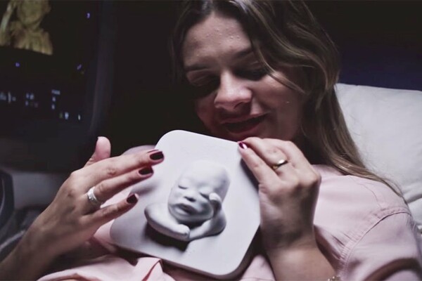 Μια τυφλή μητέρα «είδε» το αγέννητο μωρό της για πρώτη φορά 