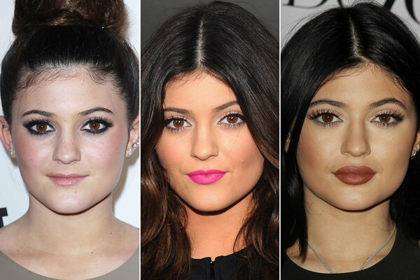 Η Kylie Jenner απαντά στη βεντούζα χειλιών και το #kyliejennerchallenge