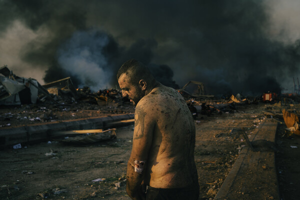 Injured Man After Port Explosion in Beirut, Lorenzo Tugnoli