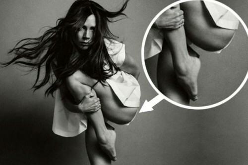 H Vogue απαντά για το "κομμένο" πόδι της Victoria Beckham