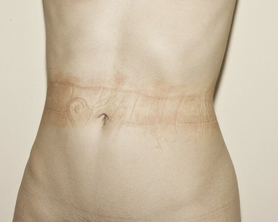 Τα αισθησιακά γυμνά της φωτογράφου Scout Paré-Phillips καταγράφουν τα σημάδια που αφήνουν τα εσώρουχα πάνω στη σάρκα