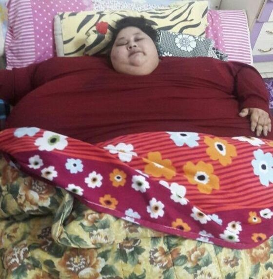 Ινδός γιατρός θα σώσει αφιλοκερδώς τη ζωή της πιο «παχύσαρκης γυναίκας» του κόσμου