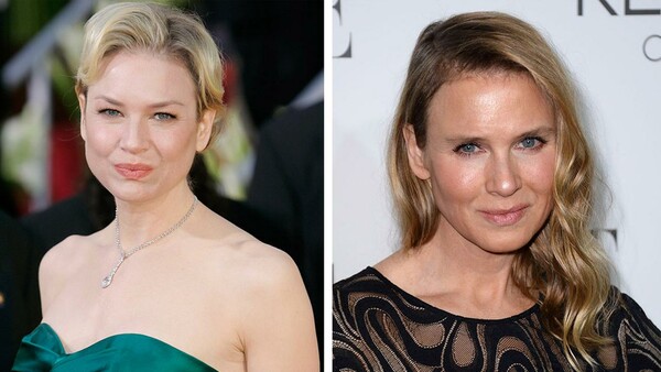 Η Renee Zellweger απαντά με ένα θυμωμένο άρθρο σε όλους όσοι την κατηγορούν για πλαστικές