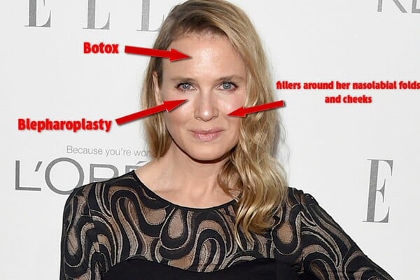 Η Renee Zellweger απαντά με ένα θυμωμένο άρθρο σε όλους όσοι την κατηγορούν για πλαστικές