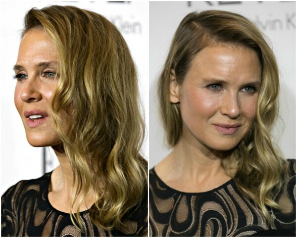 Η Renee Zellweger απαντά με ένα θυμωμένο άρθρο σε όλους όσοι την κατηγορούν για πλαστικές