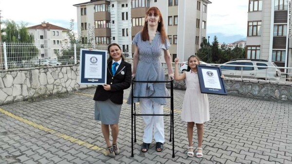 Ρεκόρ Γκίνες: H ψηλότερη γυναίκα στον κόσμο έχει ύψος 2.15 μ. και μιλά για το σπάνιο σύνδρομό της 