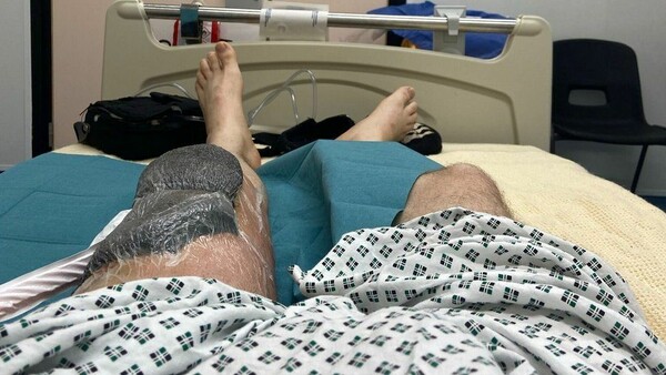 DJ έγδαρε το γόνατό του και κόντεψε να πεθάνει από λοίμωξη που του έτρωγε τη σάρκα