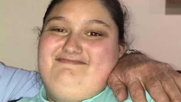 Πατέρας κρίθηκε ένοχος για τη δολοφονία της κόρης του- Την άφησε να γίνει παχύσαρκη
