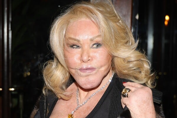 Jocelyn Wildenstein: «Δεν έχω κάνει ποτέ πλαστική επέμβαση»