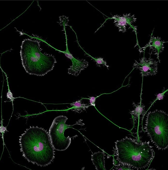 Διαγωνισμός φωτογραφίας Nikon Small World: Εντυπωσιακές εικόνες από τον μικρόκοσμο γύρω μας