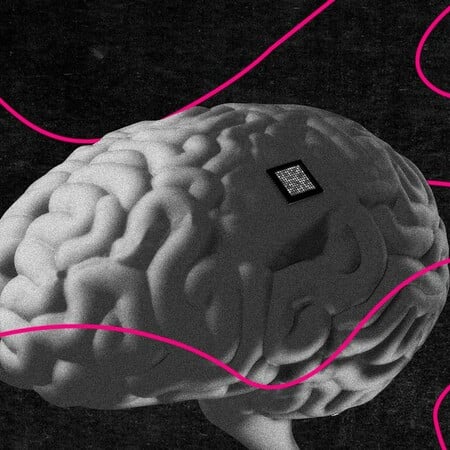 Mind Hacking: Η απειλή πίσω από τα εγκεφαλικά εμφυτεύματα