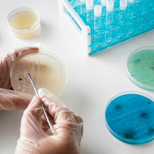 Μικροπλαστικά εντοπίστηκαν σε κάθε δείγμα από ανθρώπινους όρχεις σε επιστημονική μελέτη 