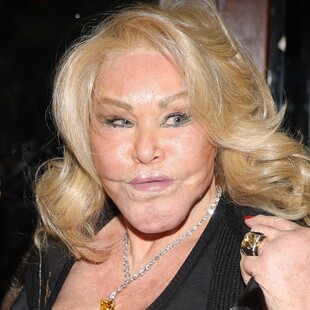 Jocelyn Wildenstein: «Δεν έχω κάνει ποτέ πλαστική επέμβαση»